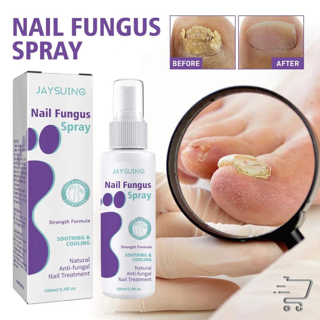 Nail Repair Spray with Thyme Oil and Peppermint Oil, before and after nail fungus treatment